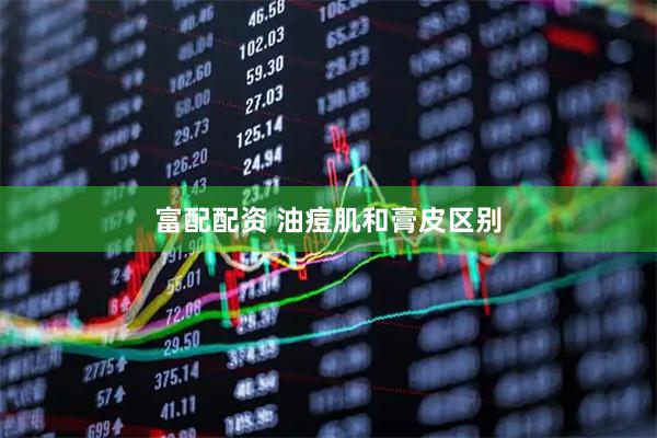 富配配资 油痘肌和膏皮区别